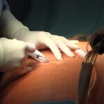 inline_image_preview