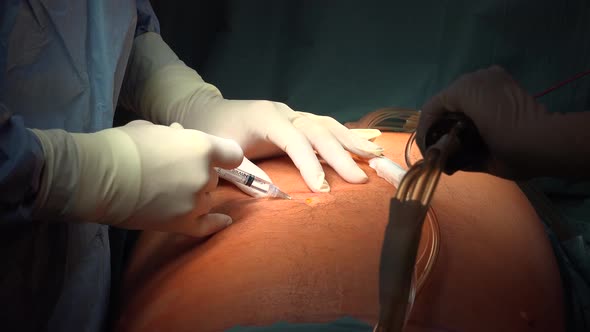 inline_image_preview